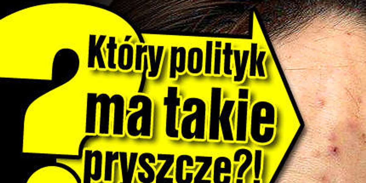 Który polityk ma takie pryszcze?!