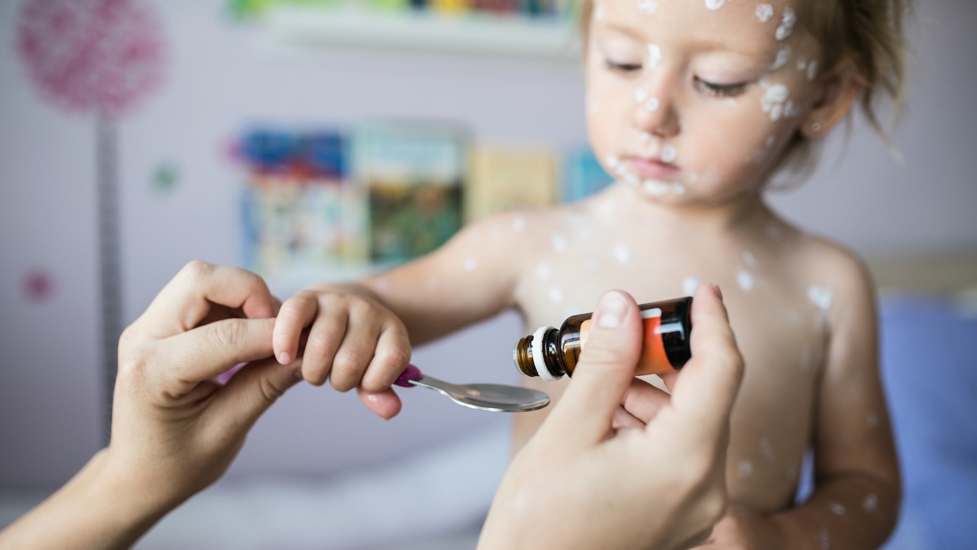 Aj vy robíte túto častú chybu, keď znižujete horúčku a vaše dieťa má ovčie kiahne? Lekárnička radí, nepoužívajte nurofen, môže viac uškodiť než pomôcť