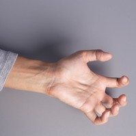 Mit jelent a kóros izommerevség?