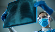  Co się dzieje z płucami podczas COVID-19? Pulmonolog: chorzy mogą stać się inwalidami 