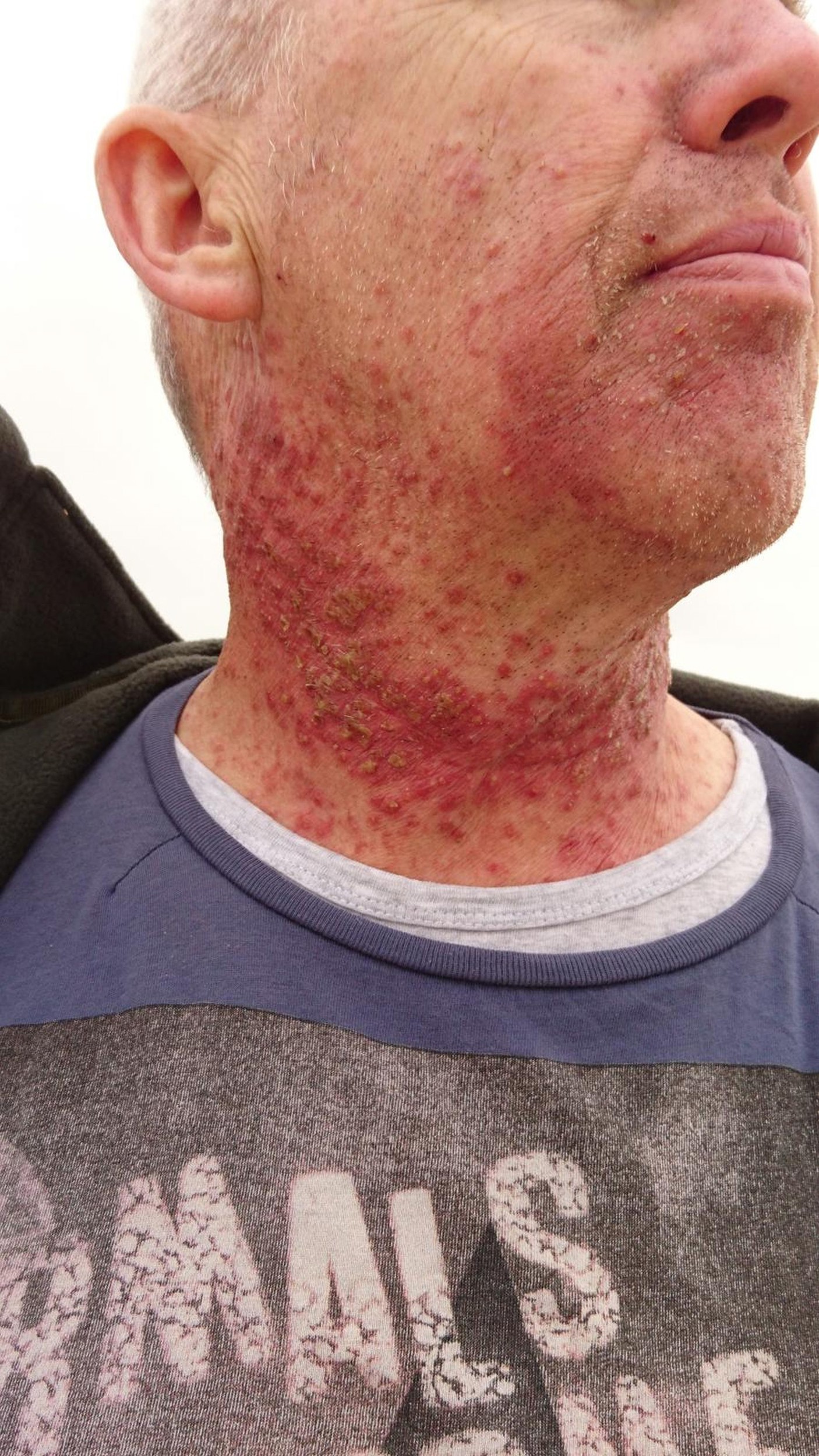 Jeff Bradford pociťoval náhle škriabanie v krku.