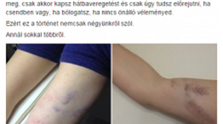 Két fiatal férfi is súlyos sérüléseket szenvedett a Fidelitas wellness disznóvágás nevű buliján / Fotó: Facebook
