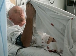 Przyszyty penis prawie jak nowy