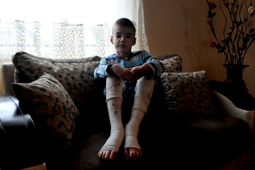 "Pomoglo mi je i što su ljudi dolazili kod nas. Svi su rekli da sam lep i hrabar dečak"