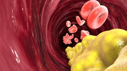 Cholesterol HDL