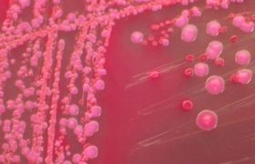 ecoli-d00000B655d17193946e2