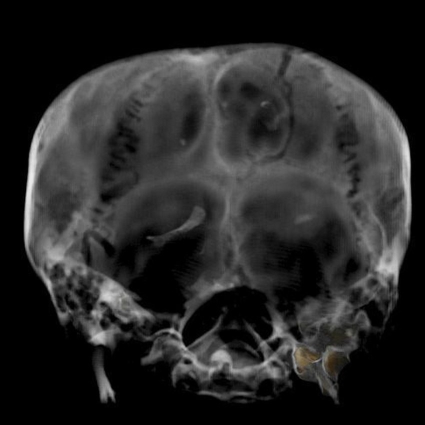 CT snimak Tutankamonove mumije