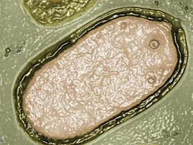 pandoravirus-permafrost-d00001AD63bb0b4583442