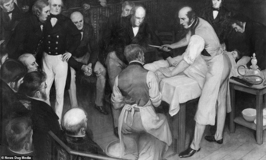 Egy amputáció során Robert Liston a bal karját használta, hogy megállítsa a véráramlást, miközben késsel hadonászott a jobb kezében. Tette ezt, miközben a beteg vonaglott, és sikoltozott félelmében és kínjában. Ernest Board ezen festményét Henry S Wellcome rendelte meg 1912 körül. Ez azt a pillanatot idézi fel, amikor Dr. Liston amputációt hajtott végre Londonban az 1840-es évek elején. A kíváncsi nézők előrehajolnak, miközben megjelenik a híres sebész, aki elmagyarázza, mit fog tenni.