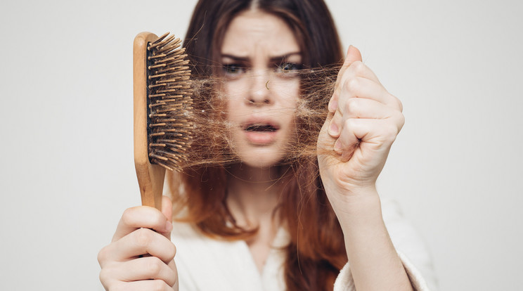 Egyéntől és akár napszaktól is függ a hajvesztés mértéke, napi 100-150 elhullajtott hajszál természetesnek tekinthető