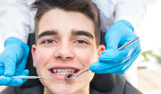 Czy każdy może założyć aparat ortodontyczny?