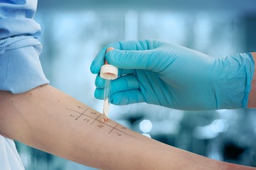 Hogyan értelmezzem az allergiavizsgálatom eredményét? Az orvos válaszol