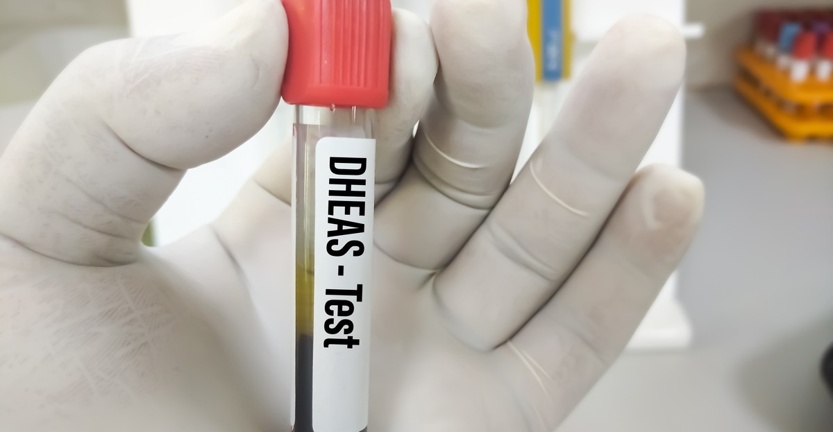 DHEASO4 badanie, normy, wskazania, przebieg i korzyści z wykonania