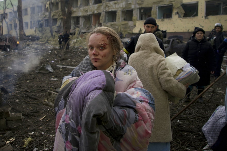 Ciężarna kobieta, która ucierpiała podczas ostrzału, jest ewakuowana z porodówki w Mariupolu w Ukrainie, 9 marca 2022 r.