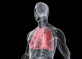 legionella-280x200-d000008B454a9a6c99b15