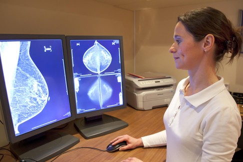 Radiology technician reviewing mammography results