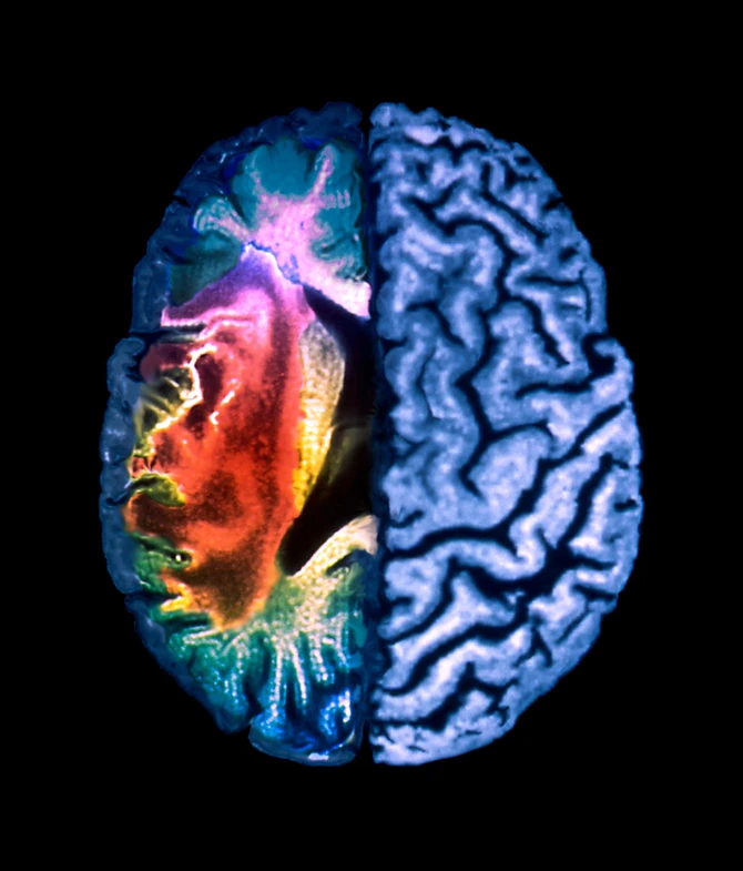 Proverite da li ste u rizičnoj grupi 