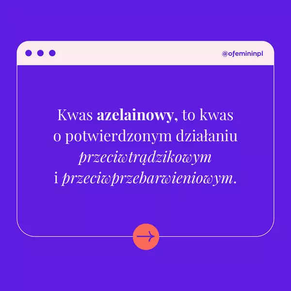 Infografika kwasy - wszystko, co powinnaś wiedzieć / ofeminin.pl