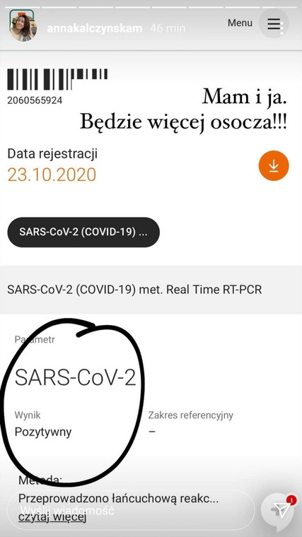 Anna Kalczyńska zakażona koronawirusem