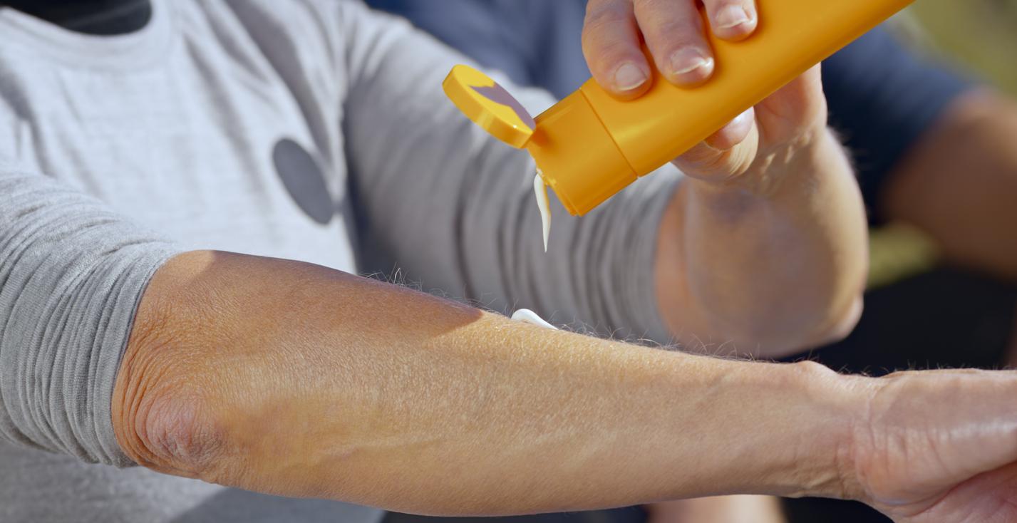 Opaľovací krém je preukázateľne najlepšou prevenciou proti vzniku rakoviny kože. (ilustračné foto)