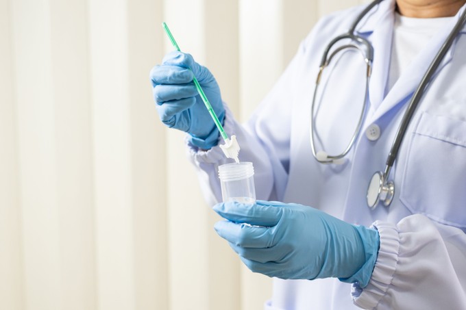 Méhnyakrák szűrés esetén ezért fontos a HPV teszt is