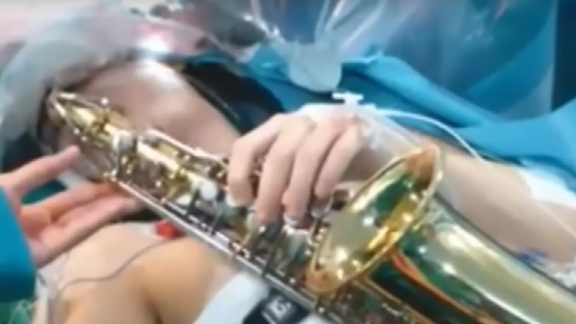 Muzyk grał na saksofonie podczas 12 godzinnej operacji mózgu. Zobacz wyjątkowy koncert