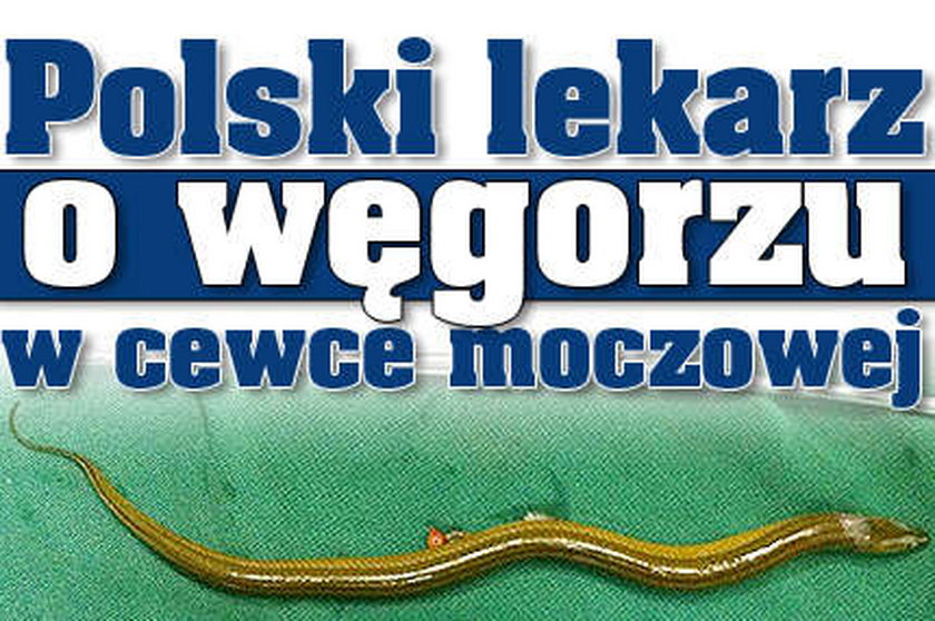 Polski lekarz o węgorzu w cewce moczowej