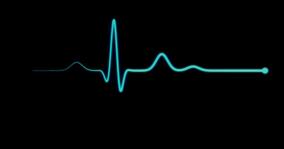 nincs szívhang EKG