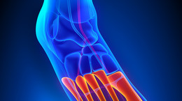 Metatarsals - structure, functions, role, injuries and diseases of the metatarsals