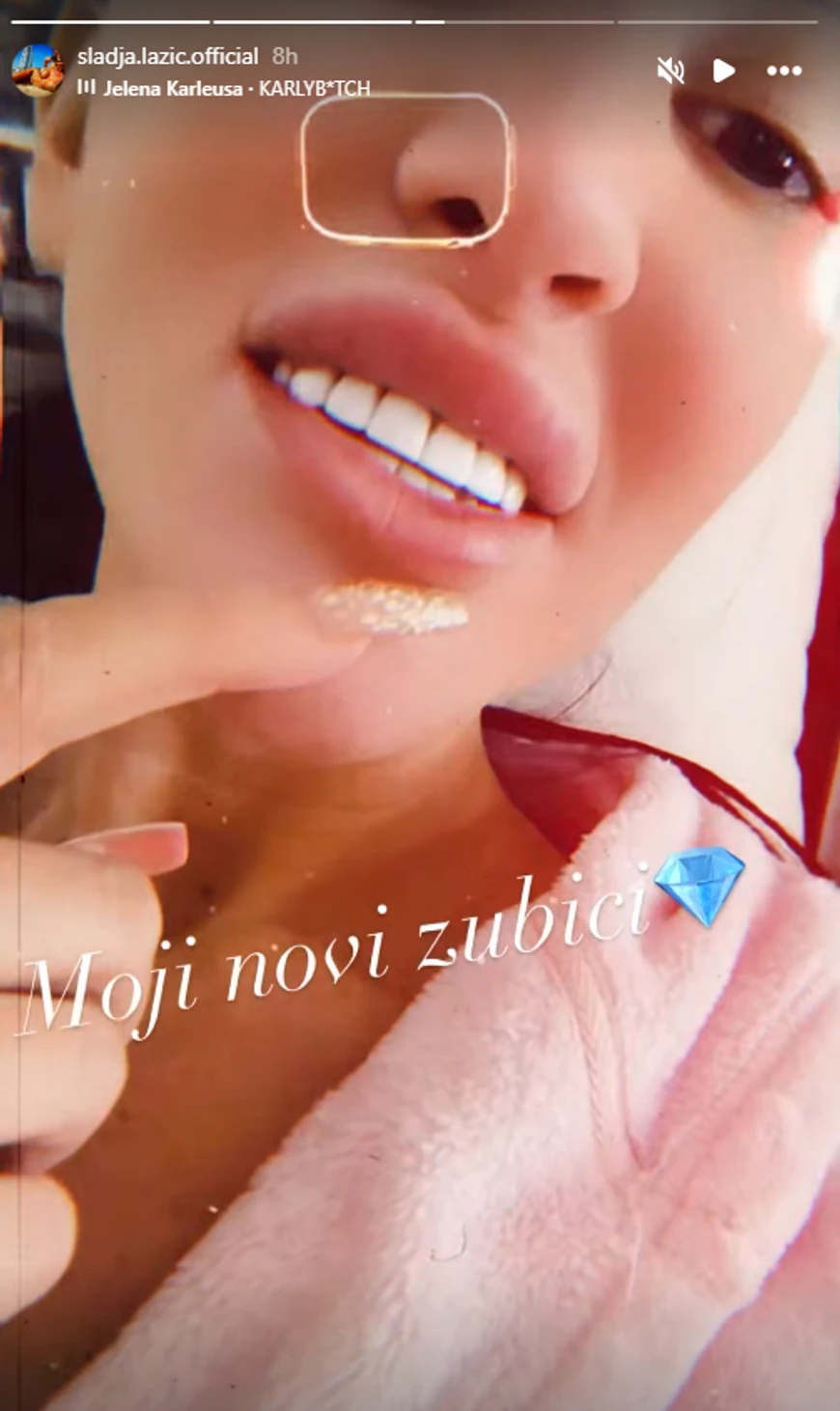 Od nekadašnje Poršeline nisu ni zubi ostali: Slađa Lazić pokazala novu promenu!