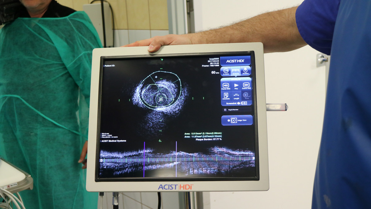 Bytomscy kardiolodzy z Wojewódzkiego Szpitala nr 4 testują najnowsze urządzenie do badań USG. Maszyna o nazwie IVUS HD pozwala na przeprowadzenie badań ultrasonograficznych wewnątrznaczyniowych, co umożliwia postawienie dokładnej diagnozy, która może uchronić pacjenta przed zawałem, a nawet śmiercią. Jeśli placówka kupi urządzenie, będzie pierwszą w Polsce dysponującą takimi sprzętem.