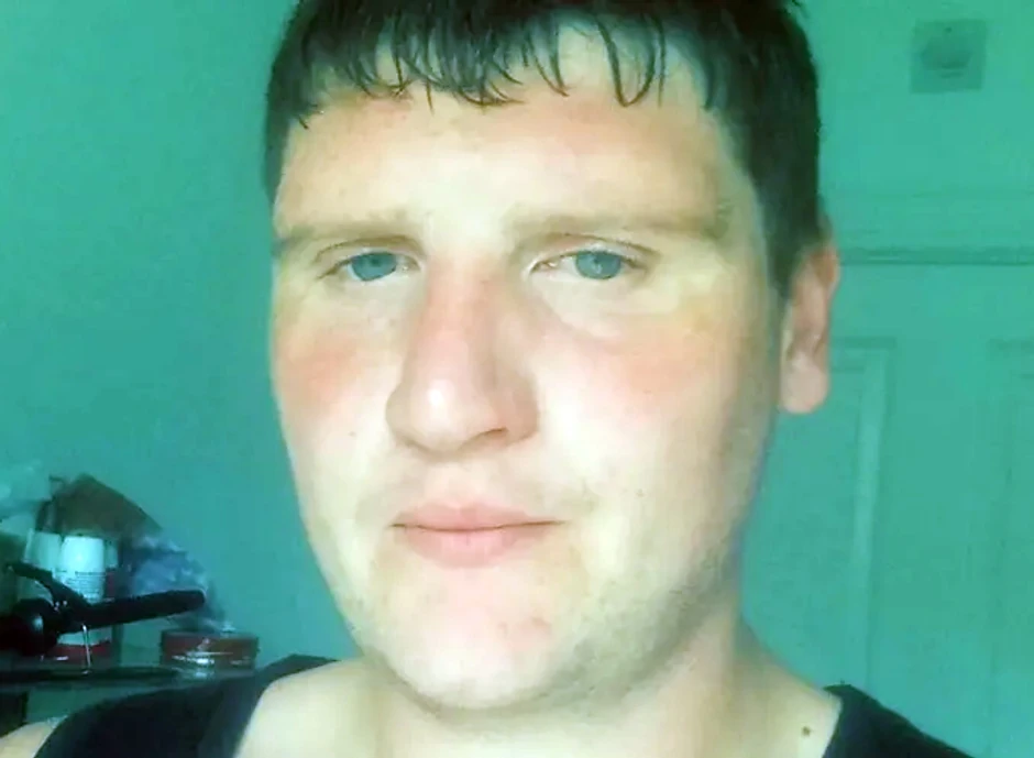 Endrju Kejn (31) radio je na farmi kada ga je ujela muva