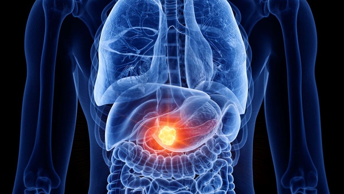 ilustracija za rak jetre