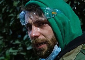 Jedan od demonstranata, Gela Hasaja, kaže da mu je koža gorela nakon što su poprskali tečnoću iz vodenog topa | Foto: Gela Khasaia