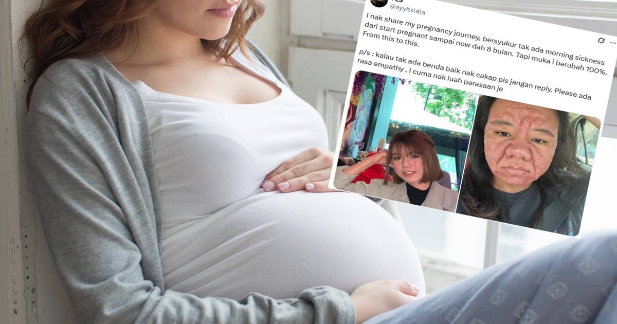 Pokazała, jak ciąża zmieniła jej twarz. Trudno uwierzyć, iż to jedna osoba