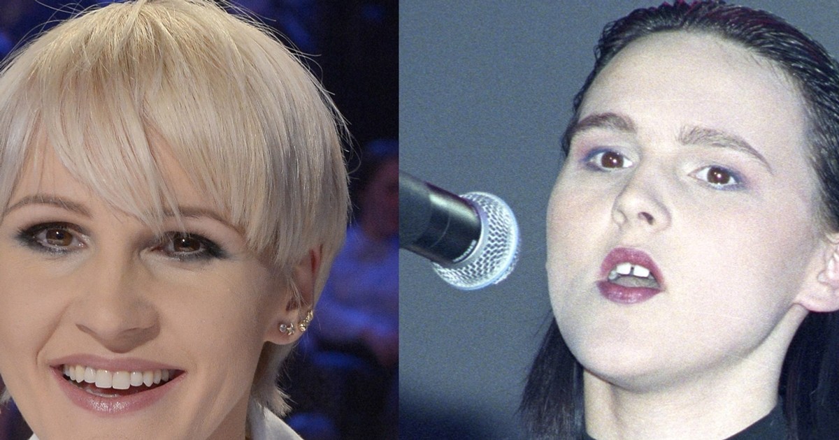 Zęby gwiazd przed i po. Zęby gwiazd. Gwiazdom urosły zęby