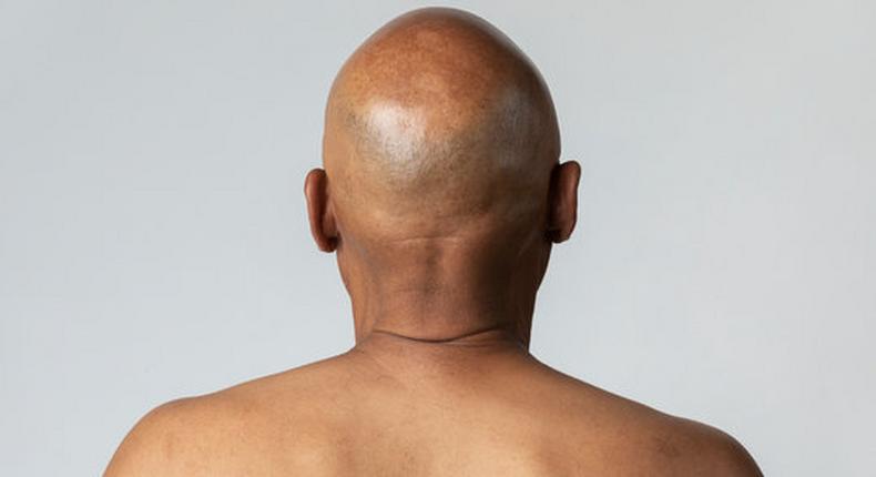 Man with bald head