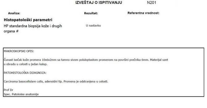Nisam bila pripremljena da čujem reči "hitna intervencija"