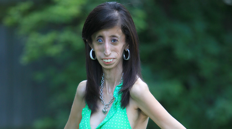 Lizzie Velasquez - Fotó: Northfoto