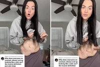 Schudła 70 kg dzięki Ozempicowi. Wywołała dyskusję, gdy odsłoniła brzuch. "Jak worek ze skórą"