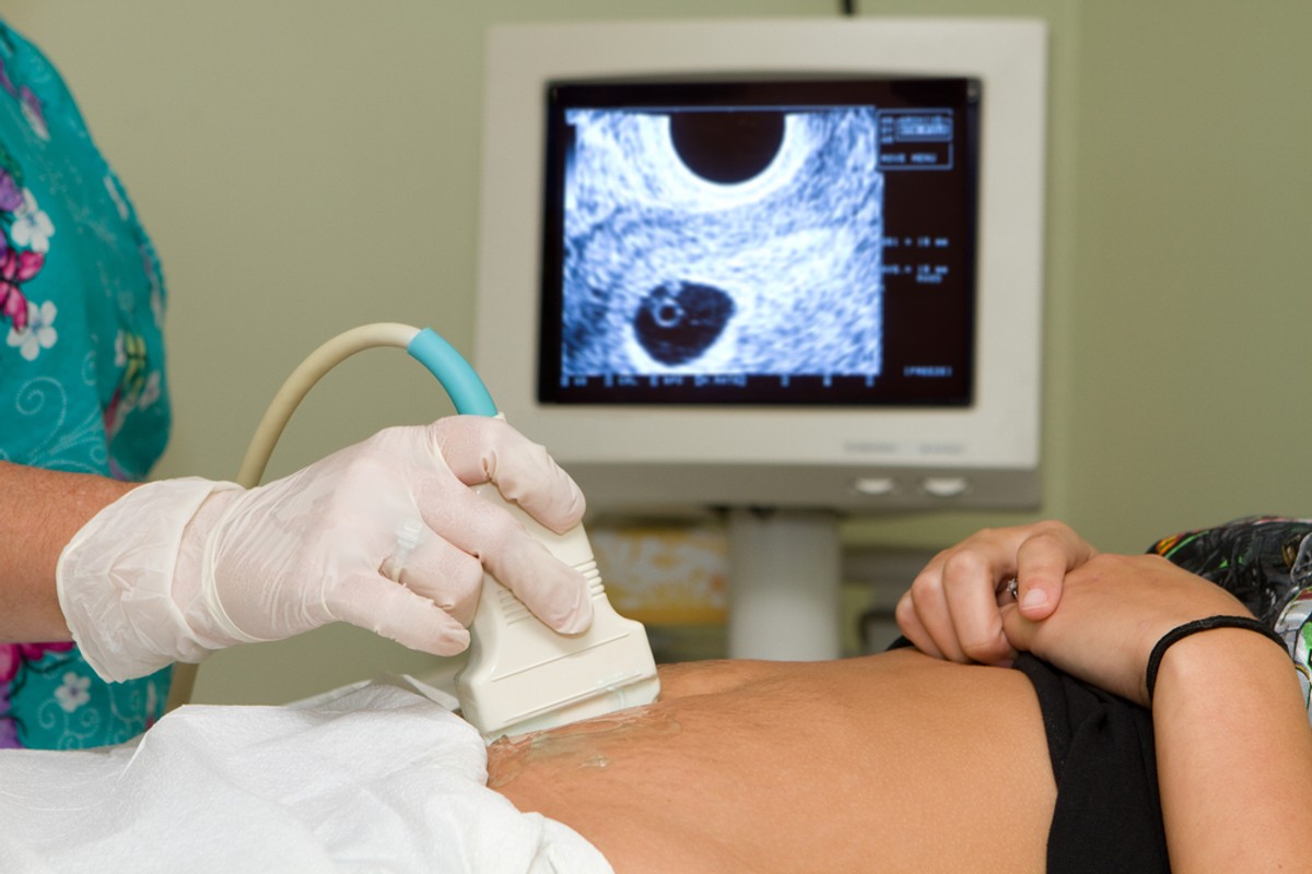 Zaostrzenie ustawy antyaborcyjnej? PiS zbiera podpisy pod nowym wnioskiem do TK