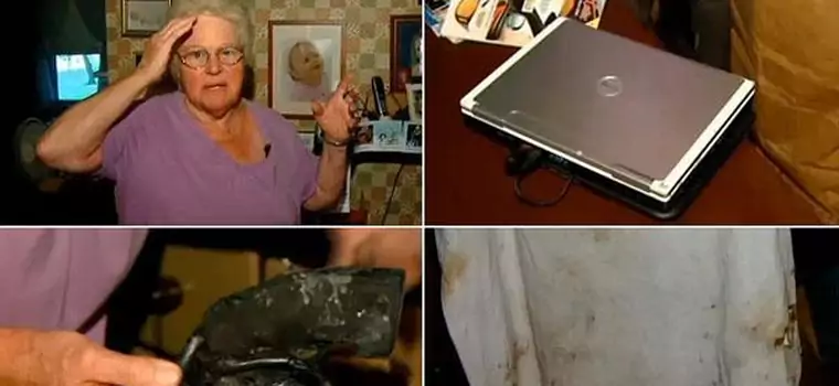 Kobieta poparzona w eksplozji laptopa