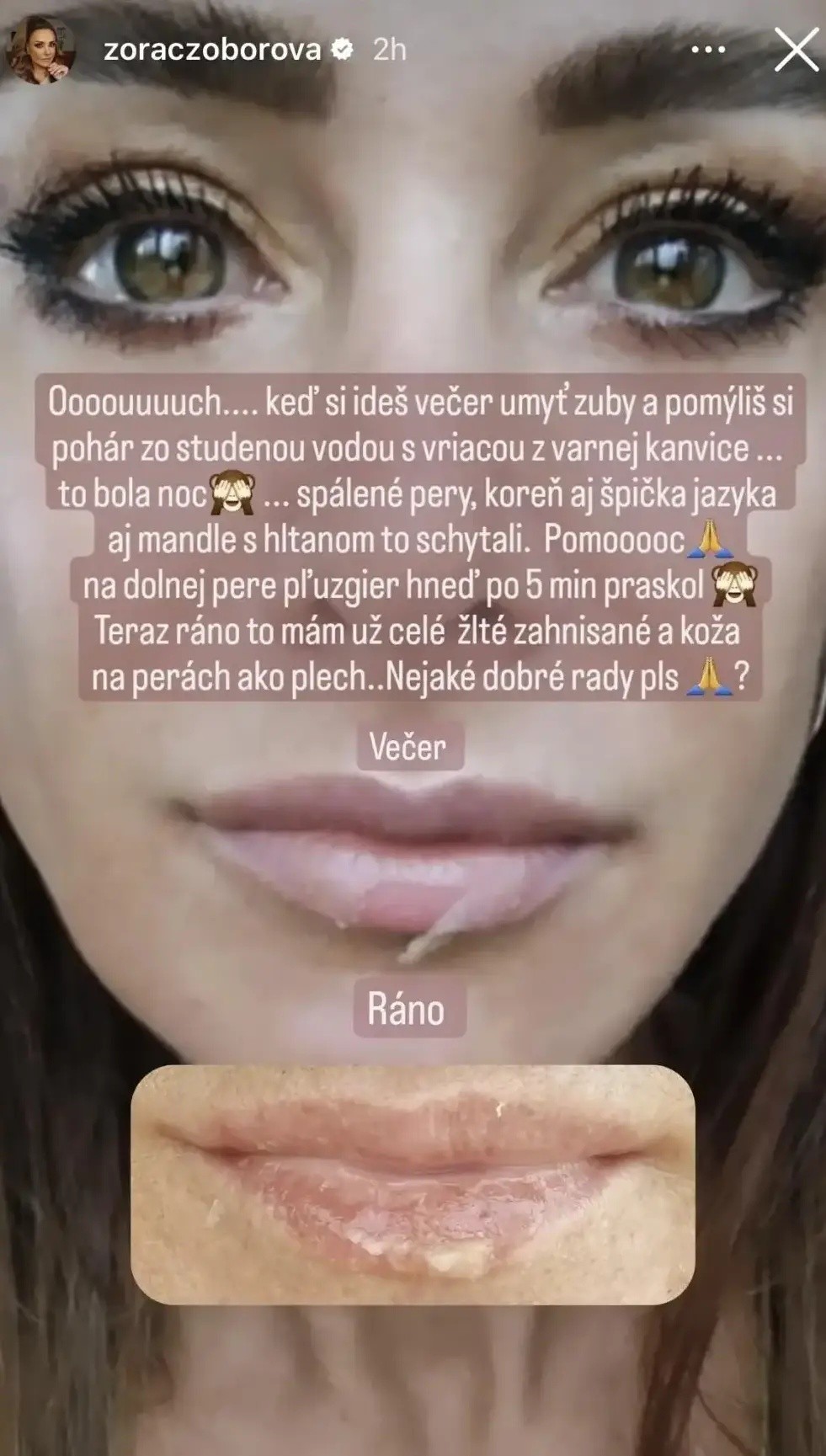 Zora zverejnila bolestivú fotku.