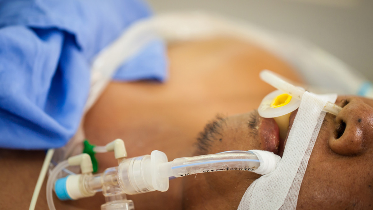 Intubacja jest zabiegiem, który polega na wprowadzeniu do tchawicy plastikowej rurki. Można to zrobić przez usta lub nos. Do wykonania zabiegu intubacji używa się laryngoskopu. Dzięki intubacji pacjent może oddychać.