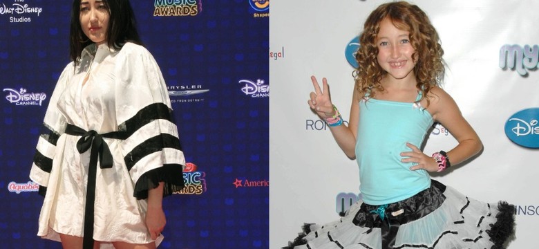 Koszmar! 17-letnia Noah Cyrus bez opamiętania traktuje twarz botoksem i wypełniaczami. FOTO