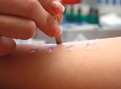 Alergicy mogą być odporniejsi na zakażenia COVID-19