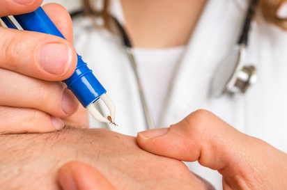 Lyme-kór fertőzés: ezekkel a betegségekkel keverhetők össze a tünetei