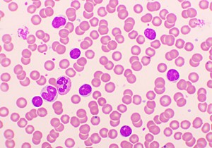 Limfociti čine 20 do 40 belih krvnih zrnaca 