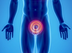 Bóle pleców, podbrzusza, kolka... to może być rak prostaty lub jądra. Jak to sprawdzić?