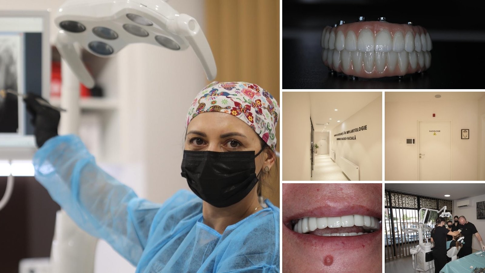 Oricine poate primi un implant dentar? Ce verifică chirurgul înainte să spună da și situațiile în care tratamentul se amână